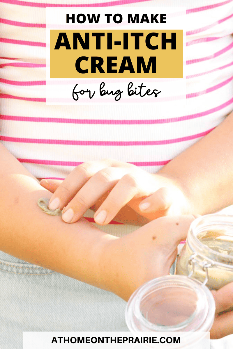 homemade anti-itch cream for bug bites